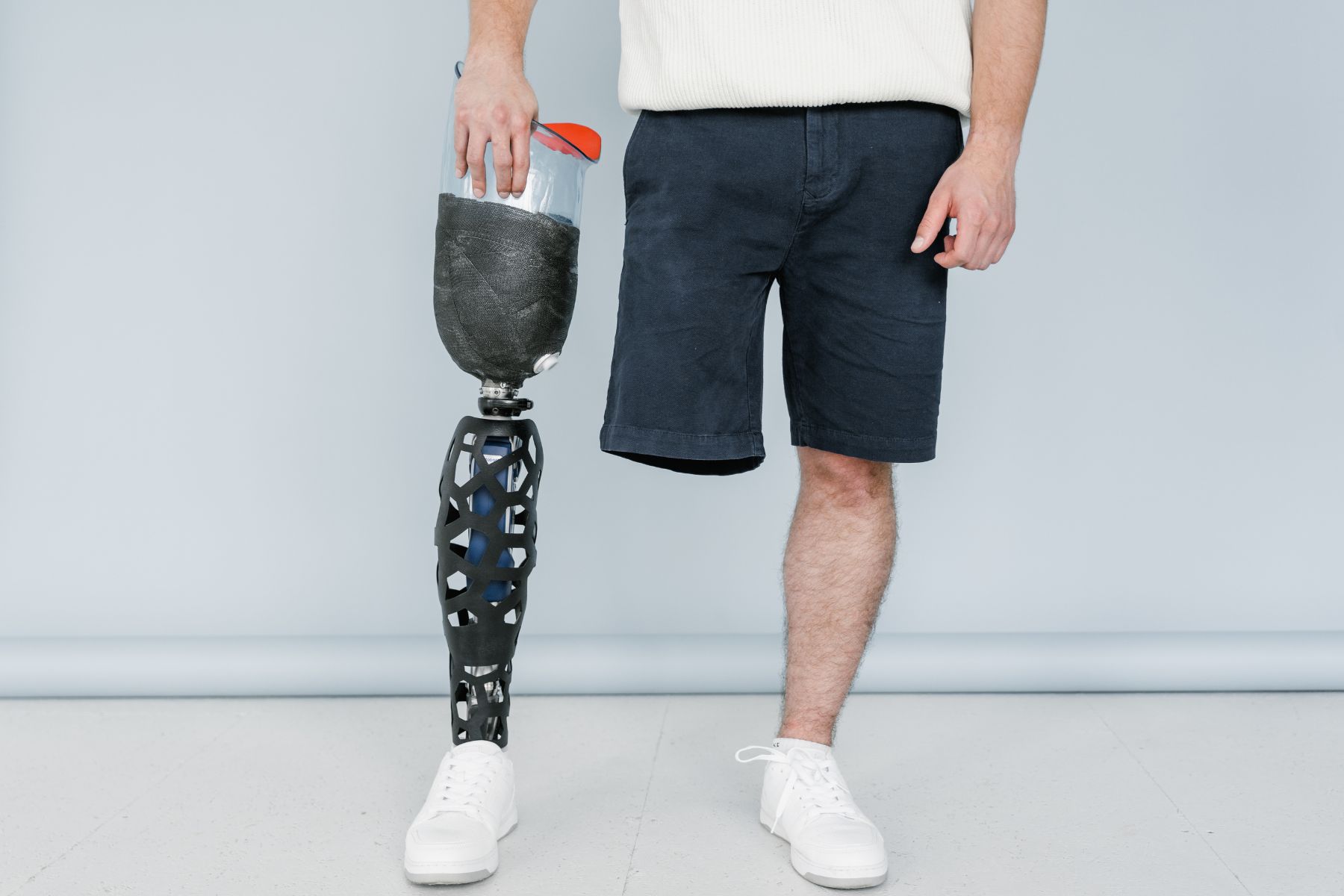 amputation compensation